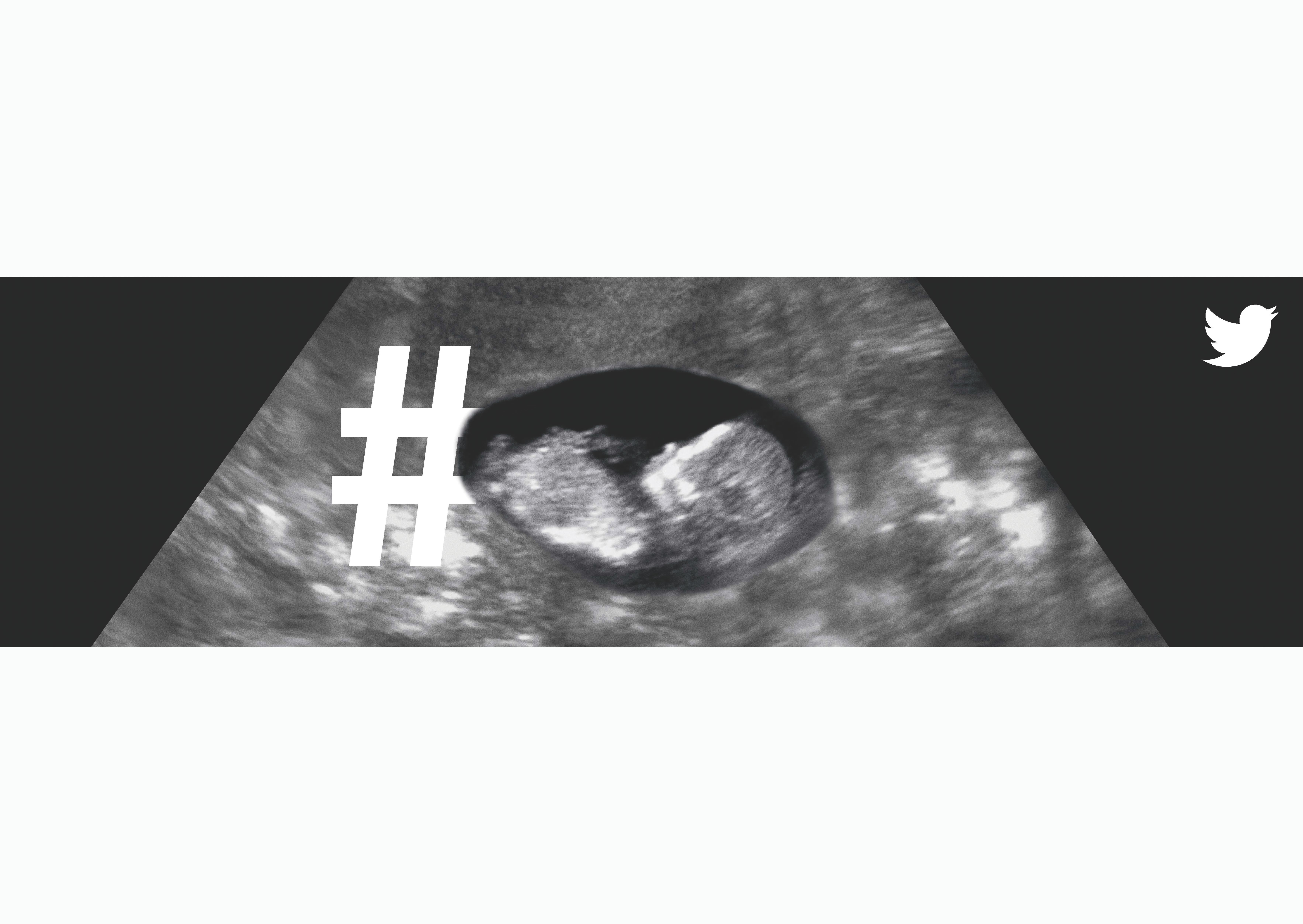 a12_007_00625_sonogram.jpg